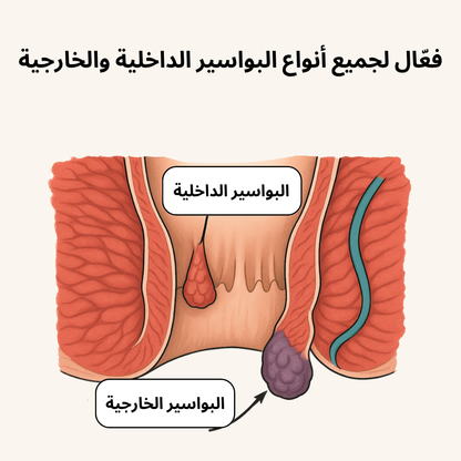 مرهم ديكتامني